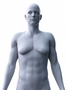 Gynecomastia